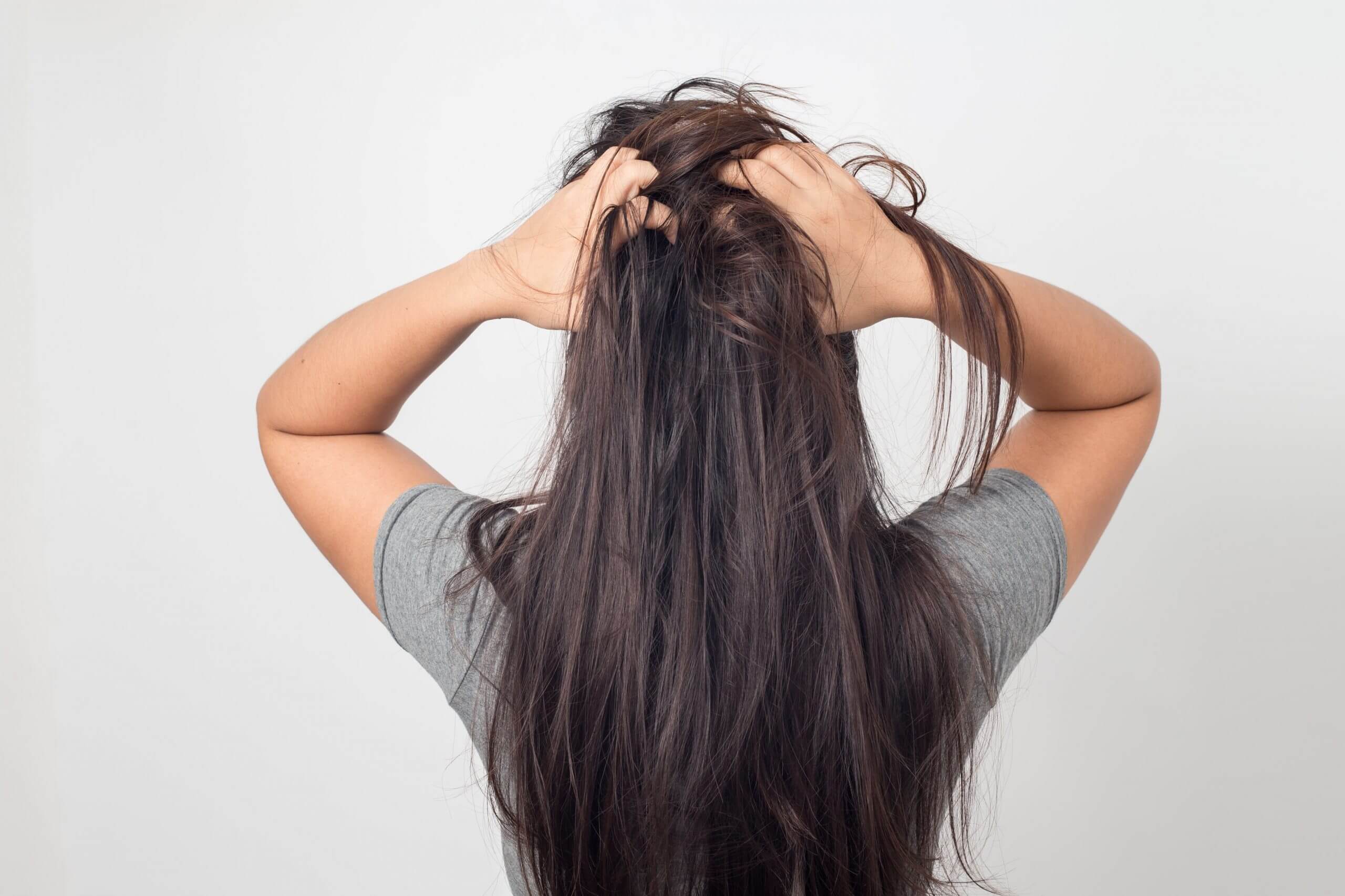 In which areas are you experiencing hair loss?